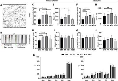 Neurofilament Light Regulates Axon Caliber, Synaptic Activity, and Organelle Trafficking in Cultured Human Motor Neurons